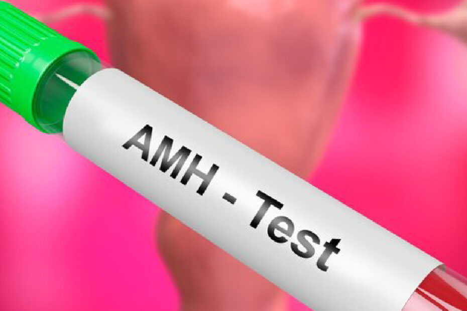 AMH blood test - What is an AMH test?