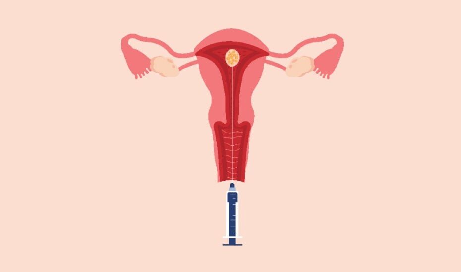 Pregnancy Symptoms After Embryo Transfer | Motherhood Fertility & IVF Center