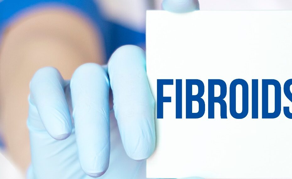 Uterine Fibroids