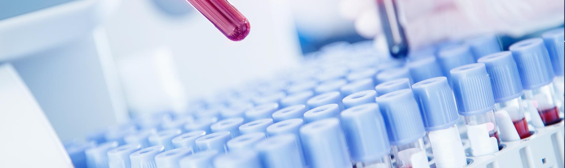 What are the different types of fertility tests for women?