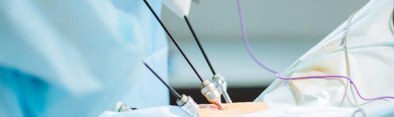 How does laparoscopy help in infertility treatment?