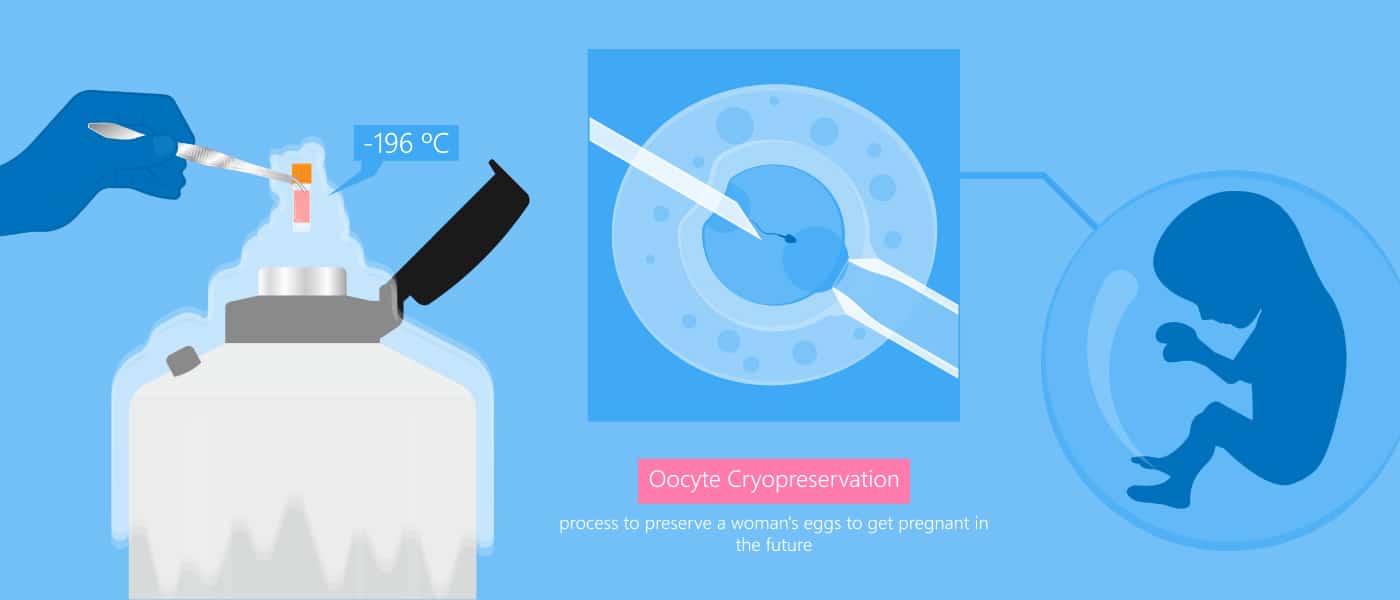 Benefits of Egg or Embryo Freezing for Later Pregnancy