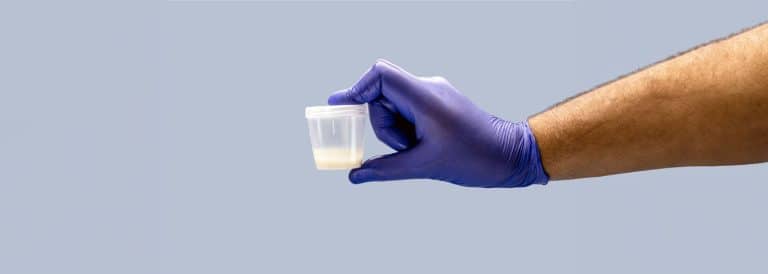 How Is Sperm Collected for IVF & IUI Treatments?