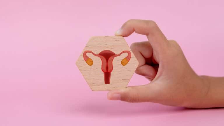 Polycystic Ovary Syndrome (PCOS) – Complete Guide