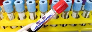 |AMH Test