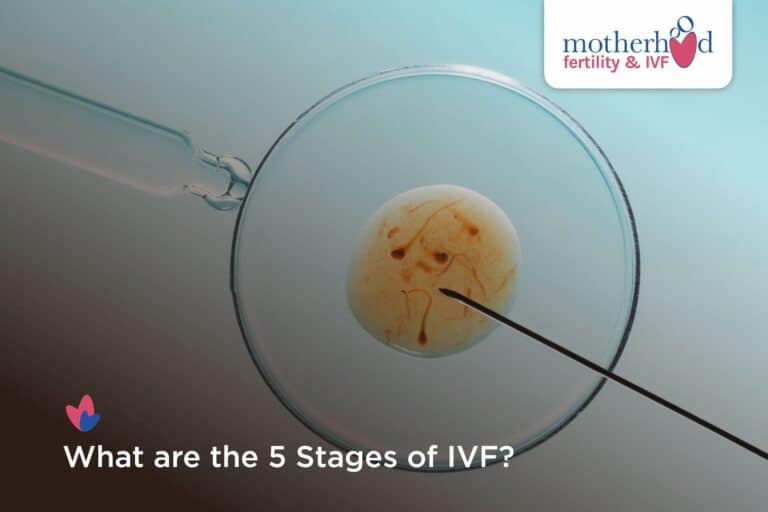 How to Handle Stress During Your IVF Journey