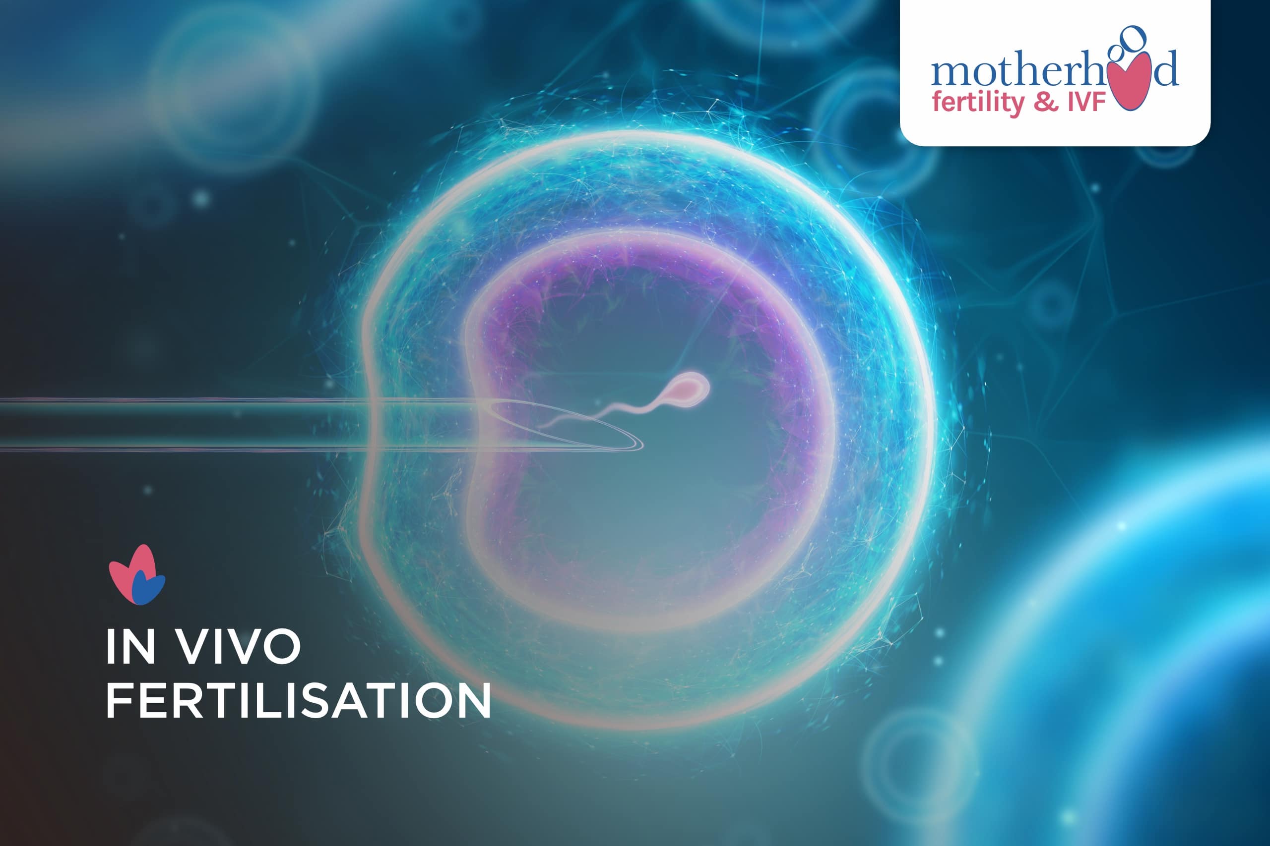 In Vivo Fertilisation Explained